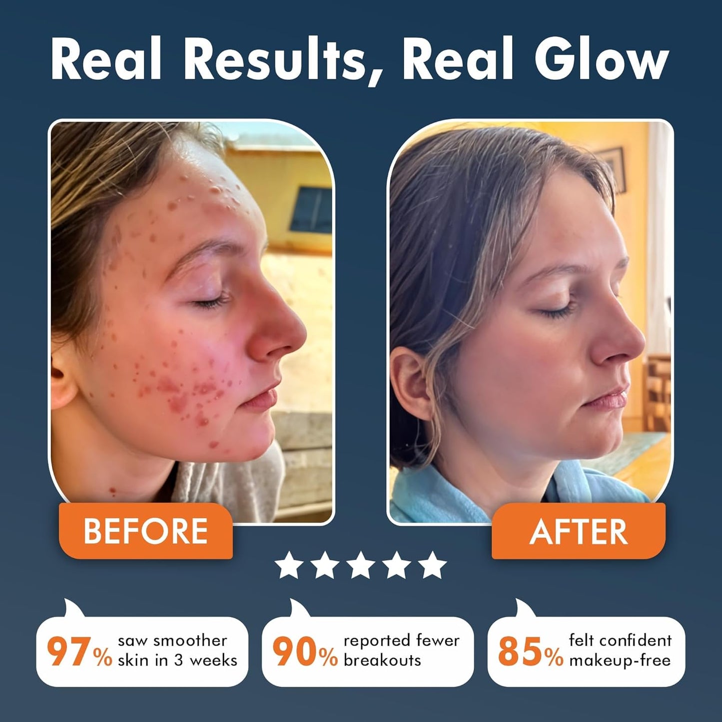 LED Face Mask | Revolutionary Therapy for Radiant & Rejuvenated Skin | Red Light Therapy Mask for Facial Care